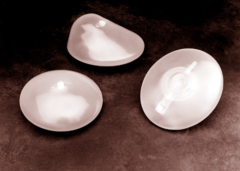 Silicone_gel-filled_breast_implants